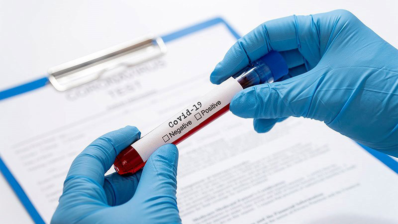 Test nhanh kháng thể Covid-19 giúp định tính kháng thể có trong mẫu máu xét nghiệm
