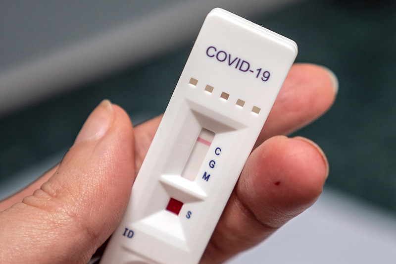 Xét nghiệm kháng thể COVID-19 dựa trên xét nghiệm huyết thanh của người bệnh