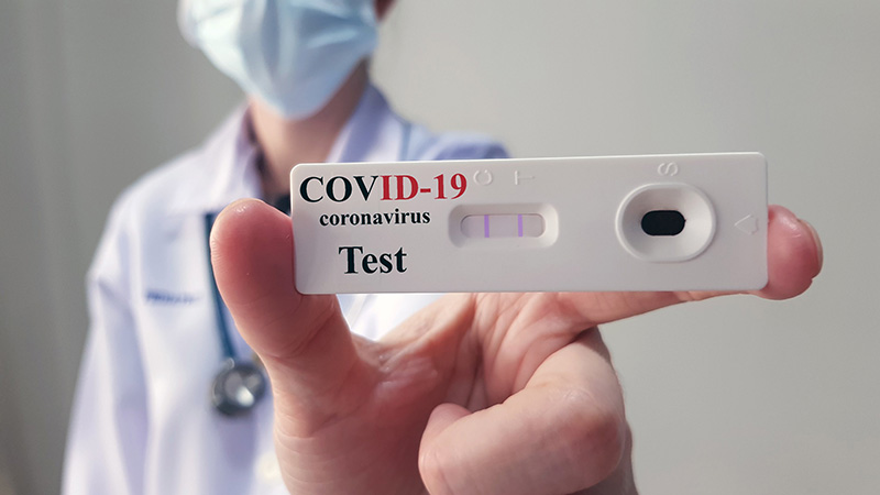 Xét nghiệm kháng thể đánh giá nguy cơ mắc COVID-19 tại các vùng dịch