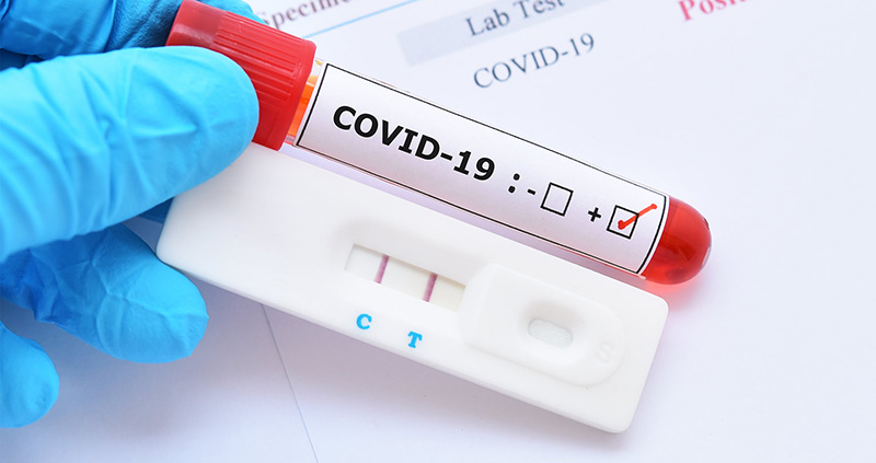 Xét nghiệm kháng thể giúp ngành y sàng lọc nguy cơ lây nhiễm COVID-19
