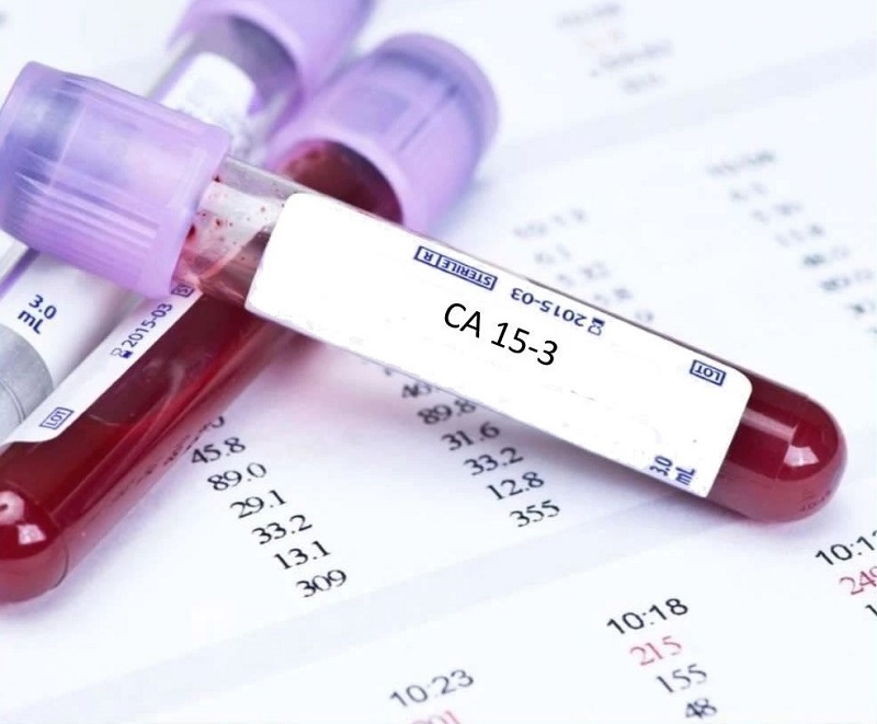 Chỉ số CA 153 được sử dụng trong tầm soát ung thư vú