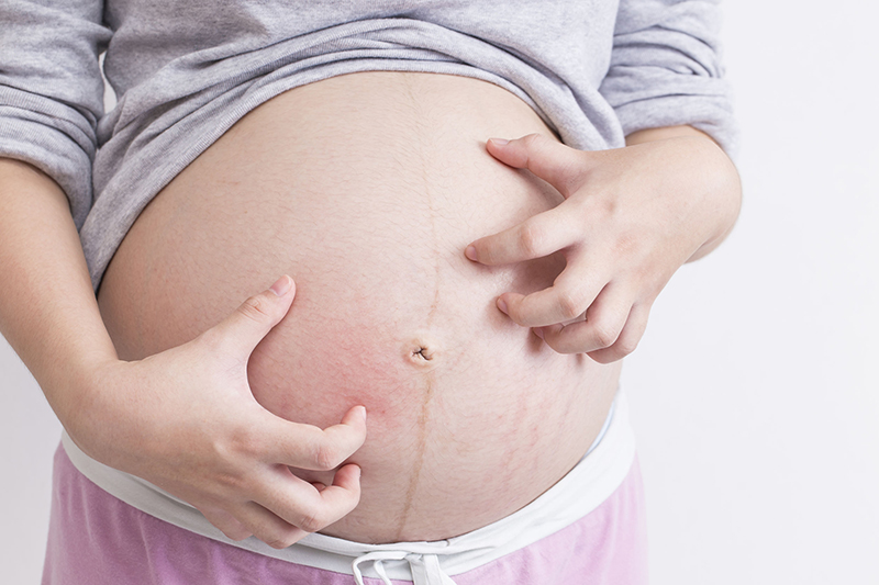 Dị ứng khi đang mang thai gián tiếp ảnh hưởng đến thai nhi của bạn 