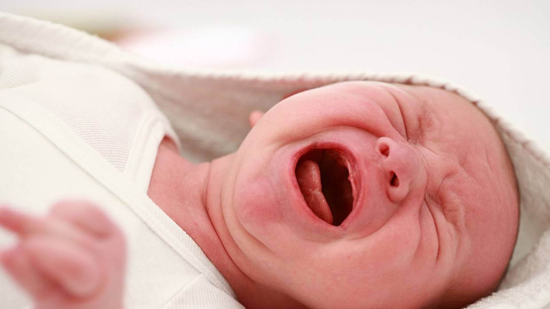 Thoát vị bẹn ở trẻ sơ sinh có thể gây biến chứng khó điều trị