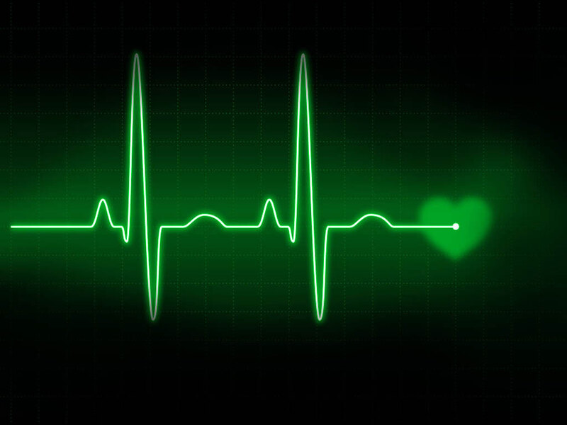 Điện tim đồ giúp chẩn đoán nguyên nhân gây phù phổi cấp