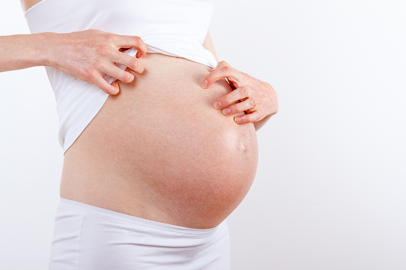 Ngứa ngáy trong viêm da cơ địa là một trong những triệu chứng ảnh hưởng đến mẹ bầu nhiều nhất