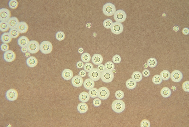 Nhiễm Cryptococcus là một căn bệnh xảy ra nếu một người hít phải các bào tử nấm