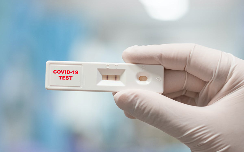 Test nhanh Covid giúp phát hiện sự có mặt của kháng nguyên của virus SARS-CoV-2 giai đoạn sớm