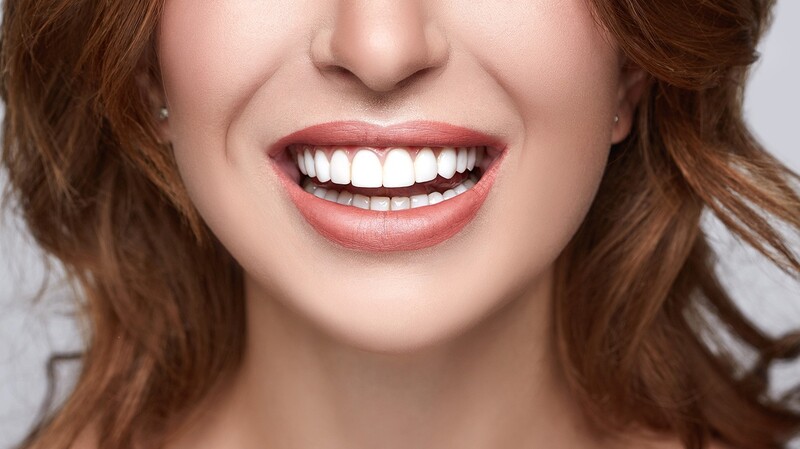 Tẩy trắng răng thực chất dùng các chất và ánh sáng để oxy hóa chất hữu cơ làm xỉn màu răng