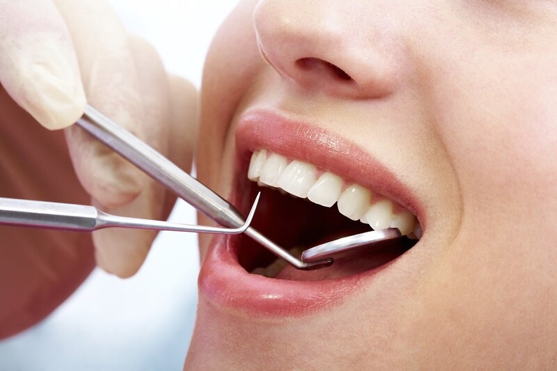 Người bị kích ứng với thành phần của thuốc tẩy không nên tẩy trắng răng