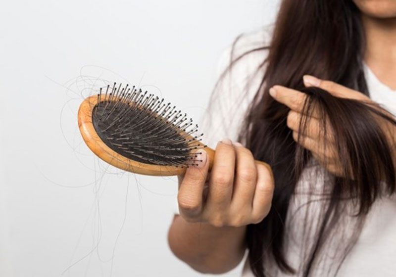 Bệnh nhân có thể đối mặt với tình trạng rụng tóc nghiêm trọng