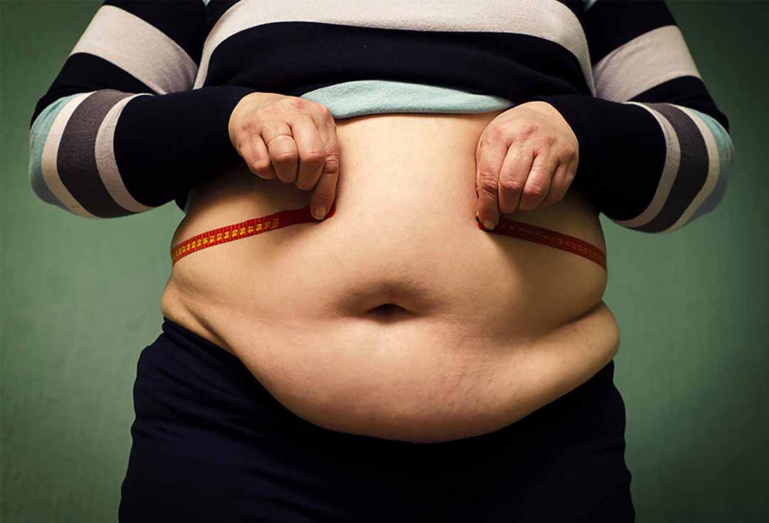 Béo phì thường làm tăng áp lực cho vùng bụng, khiến dịch dạ dày và acid dễ bị đẩy lên cơ vòng thực quản hơn