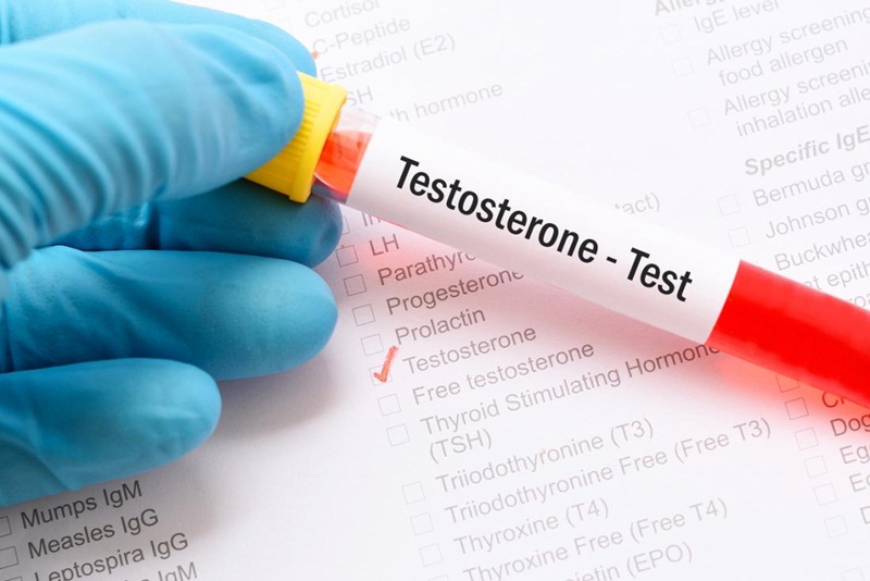 Nên xét nghiệm nồng độ testosterone vào buổi sáng để có kết quả chính xác nhất