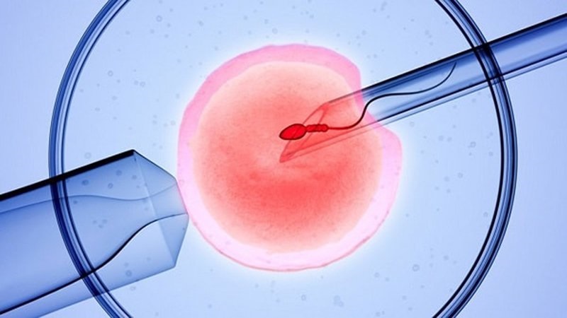 Phương pháp thụ tinh trong ống nghiệm (hay còn gọi là IVF)