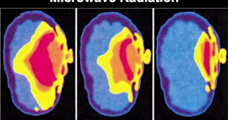 Bức xạ điện từ gây ảnh hưởng xấu đến não và hệ thần kinh, tăng nguy cơ ung thư