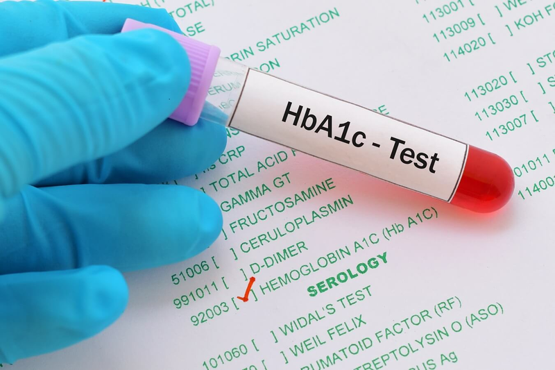 Xét nghiệm HbA1c máu là một dạng xét nghiệm đường huyết