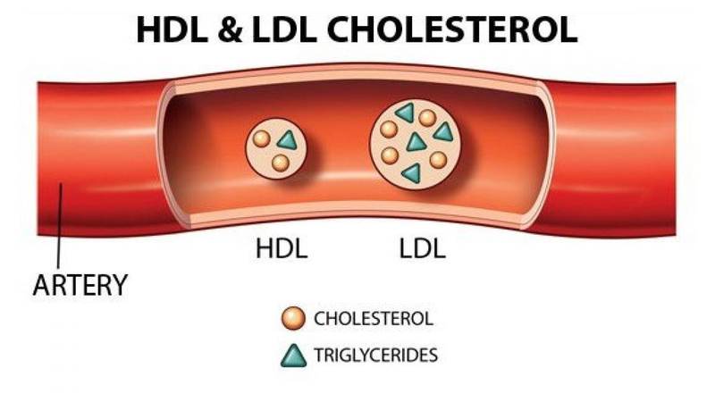 HDL - Cholesterol là chất béo tốt chống lại quá trình xơ vữa động mạch