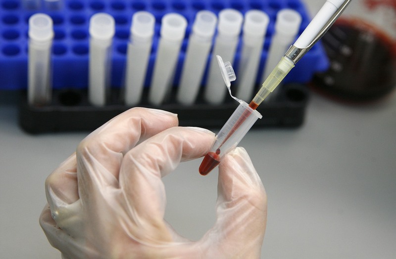 Xét nghiệm HIV sớm có thể cho kết quả âm tính giả