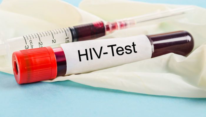 Xét nghiệm HIV tại bệnh viện có thể phát hiện Covid-19 sớm hơn