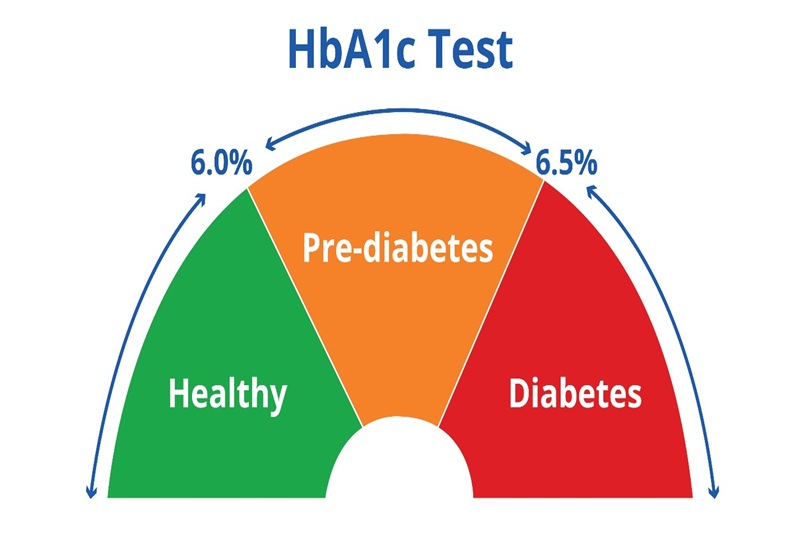 Chỉ số HbA1c > 6.5% cho thấy khả năng kiểm soát glucose trong máu kém