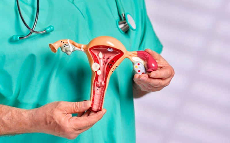 Lạc nội mạc tử cung làm giảm khả năng thụ thai thành công