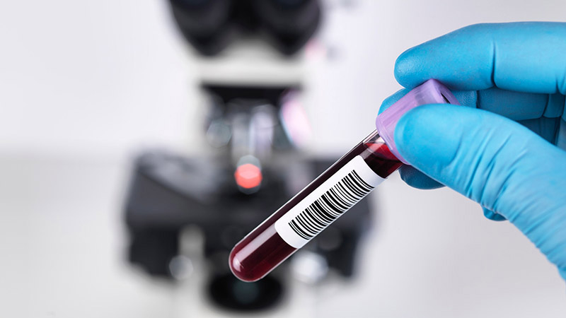 Xét nghiệm kháng thể được tiến hành bằng cách lấy máu