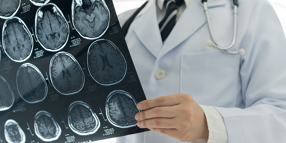 Chụp CT sọ não là phương pháp sử dụng chùm tia X đi qua vùng đầu của bệnh nhân, sau đó máy sẽ thu nhận các chùm tia X này để xử lý và chuyển đổi, từ đó đưa ra các góc nhìn khác nhau từ nhiều phía về các cấu trúc của sọ não cũng như các tổn thương nếu có