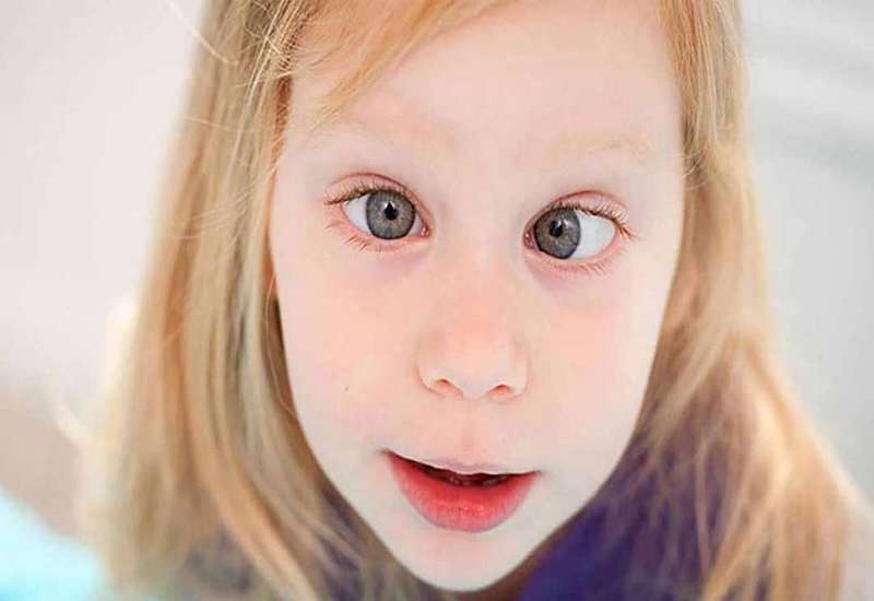 Trẻ bị lác mắt có thể chữa trị qua phẫu thuật