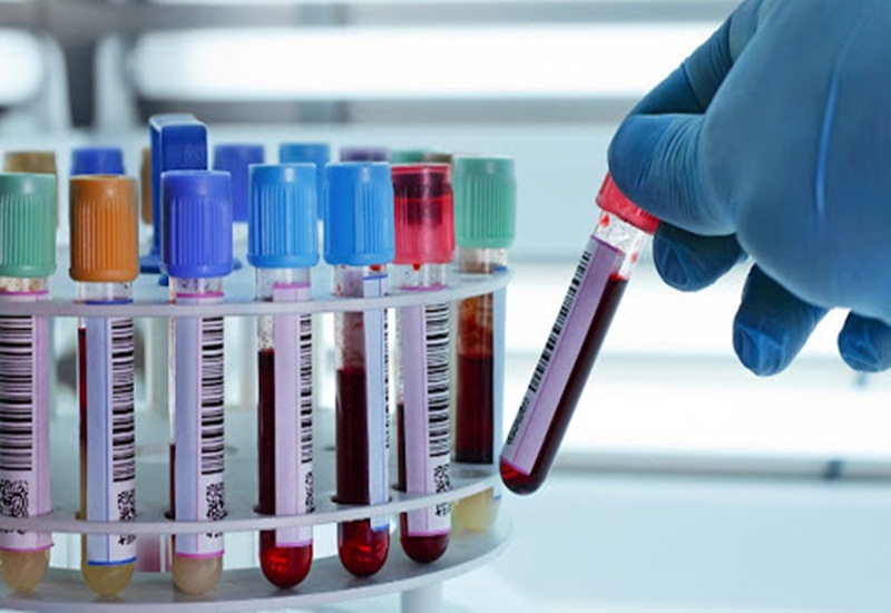 Xét nghiệm máu giúp chẩn đoán ung thư