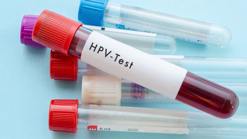Xét nghiệm HPV giúp bác sĩ chẩn đoán đúng bệnh để đưa ra phương pháp điều trị mụn cóc sinh dục hiệu quả