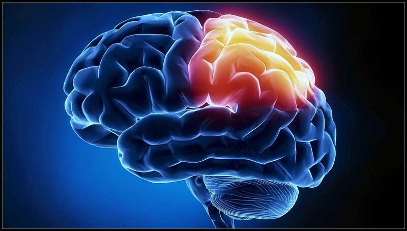 Đau đầu nguyên phát do não hoạt động quá mức hoặc bất thường cấu trúc