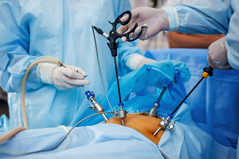 Nếu buồng tử cung bị dính, bạn nên thực hiện phẫu thuật nội soi để lớp niêm mạc phát triển một cách bình thường
