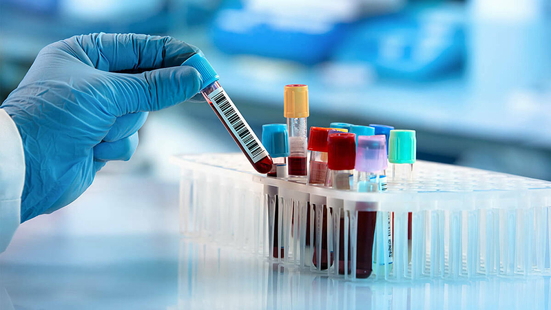 Xét nghiệm máu để phát hiện vi khuẩn HP rất dễ cho kết quả dương tính giả