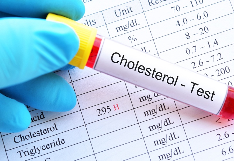 Kiểm tra máu để biết chính xác lượng cholesterol trong cơ thể