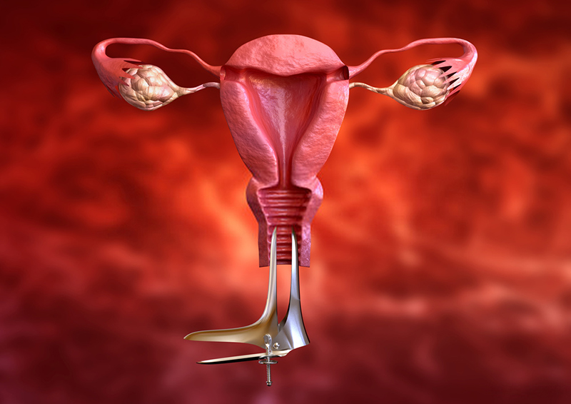   Sinh thiết cổ tử cung là một kỹ thuật xâm lấn được thực hiện để đánh giá, phát hiện khả năng ung thư cho nữ giới