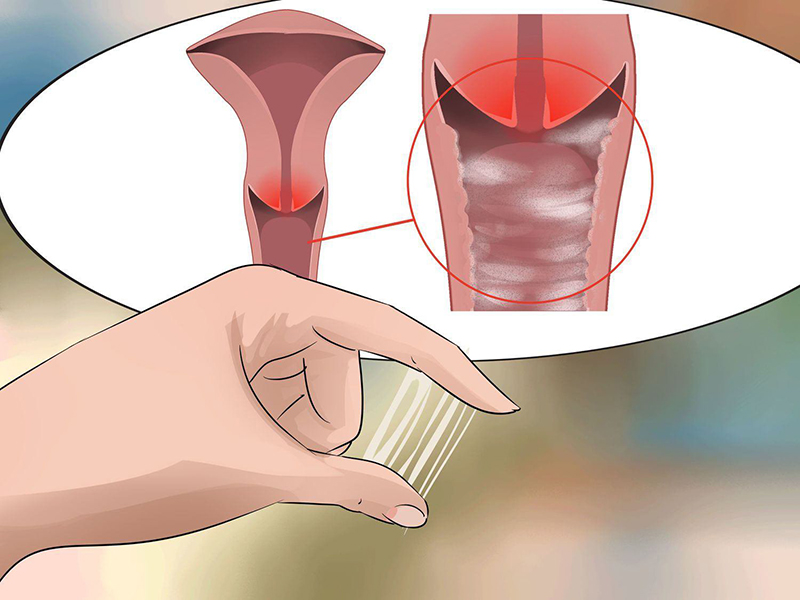 Nữ giới bị viêm hoặc ngứa không rõ nguyên nhân cần thực hiện kiểm tra, sinh thiết tại cổ tử cung