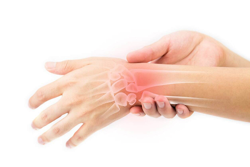 Viêm bao gân cổ tay là tình trạng tổn thương các gân bao quanh cổ tay