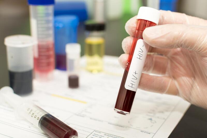 Xét nghiệm NAT là xét nghiệm sinh học phân tử giúp xác định sự có mặt của virus hay vi khuẩn trong mẫu vật phẩm