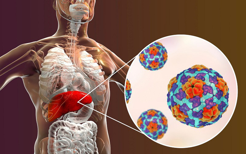  Sinh thiết gan giúp xác định mức độ tổn thương do virus viêm gan C