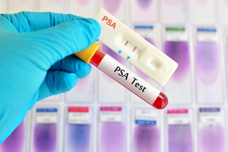 Xét nghiệm PSA dùng trong sàng lọc ung thư tuyến tiền liệt