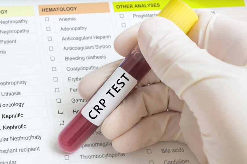 Xét nghiệm CRP chỉ ra tình trạng viêm nhiễm trong cơ thể