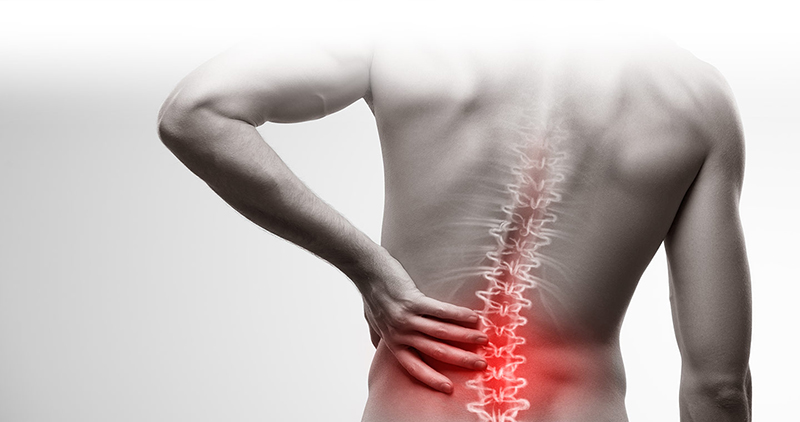 Triệu chứng thoát vị đĩa đệm cột sống thắt lưng thường là những cơn đau ở vùng thắt lưng