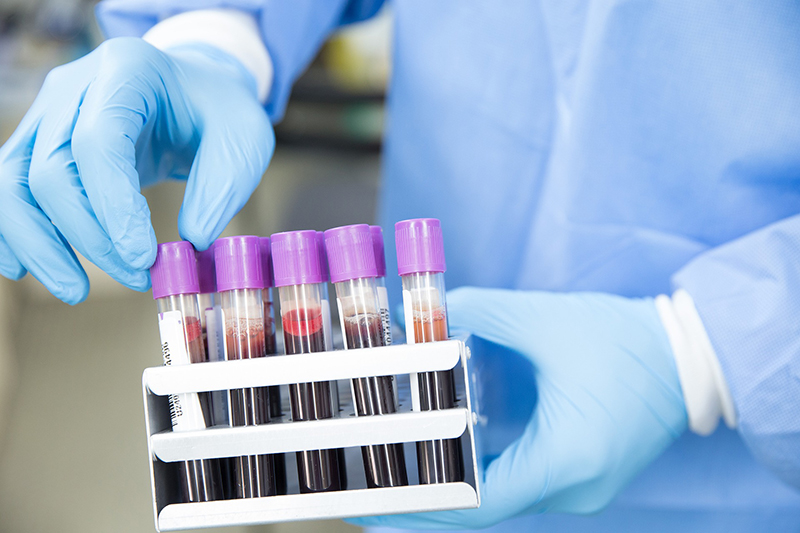 Trước khi làm xét nghiệm gen Thalassemia, bác sĩ sẽ yêu cầu bạn thực hiện trước các xét nghiệm cần thiết như: phân tích máu