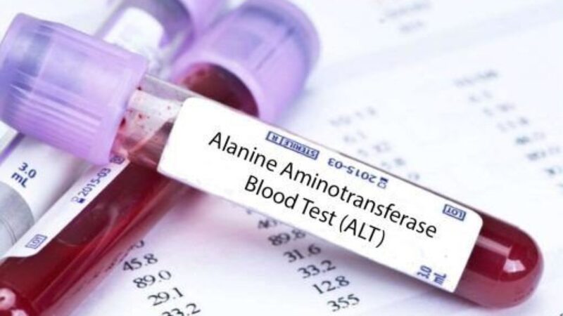  Xét nghiệm ALT giúp đánh giá tình trạng hoại tử tế bào gan