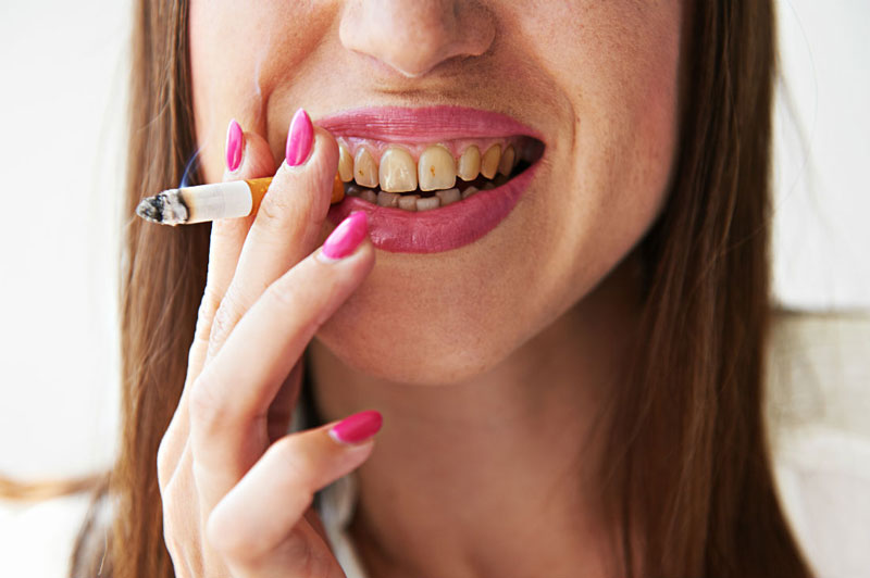 Bạn có biết hút thuốc ảnh hưởng đến răng miệng cực kỳ nghiêm trọng