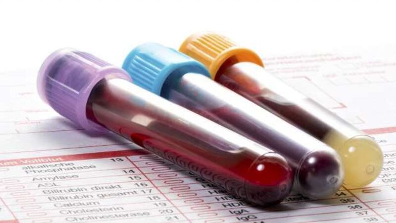 Xét nghiệm công thức máu là xét nghiệm máu cơ bản