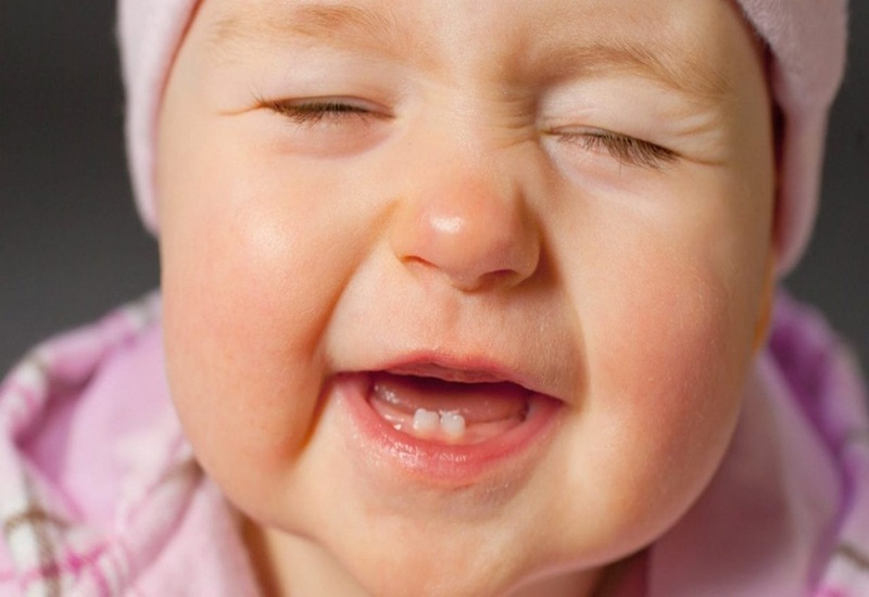 Trẻ có thể sốt do mọc răng