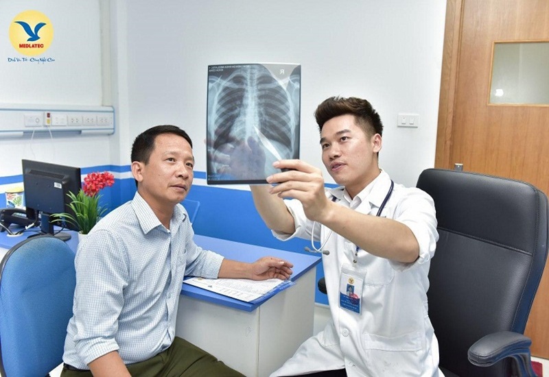 Chụp X-quang phổi để chẩn đoán bệnh