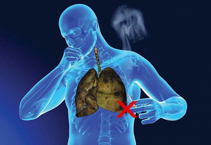 Thói quen hút thuốc lá ảnh hưởng đặc biệt nghiêm trọng đến phổi