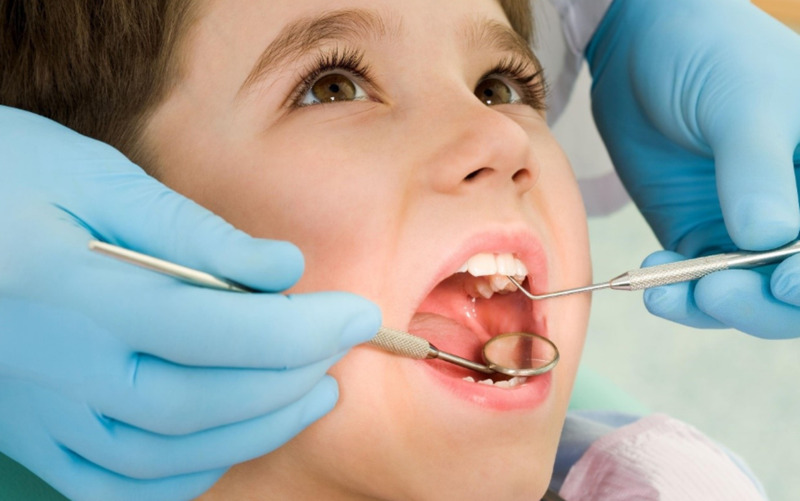 Trẻ thay răng sớm có thể do sâu răng hoặc bệnh lý răng miệng khác