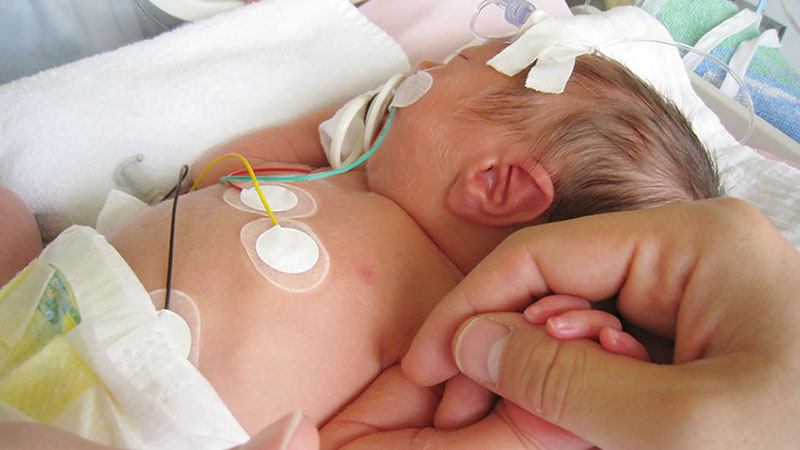 Tim bẩm sinh là dị tật phổ biến nhất ở trẻ sơ sinh